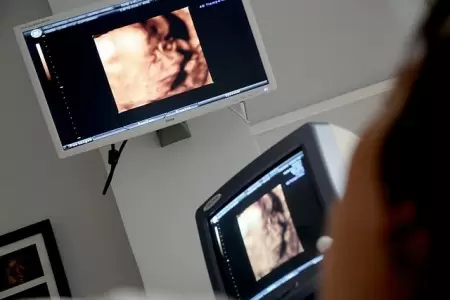 Radiodiagnòstic i radiologia : tècniques d'imatge