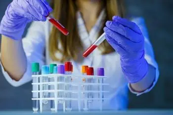 Zweige der Chemie: Hauptdisziplinen und Merkmale